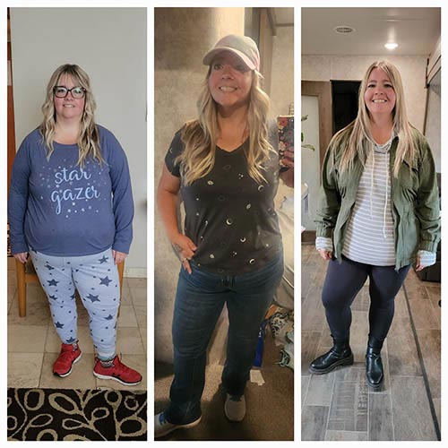 tijuana-bariatrics-gastric-sleeve-before-after_Brittany-Dockstader
