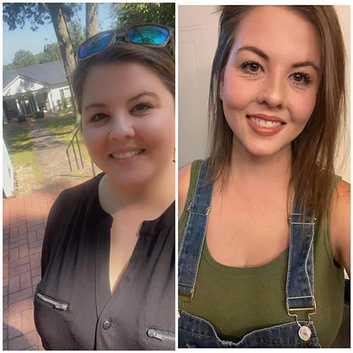 tijuana-bariatrics-gastric-sleeve-before-after_Desirae-Howard-carter