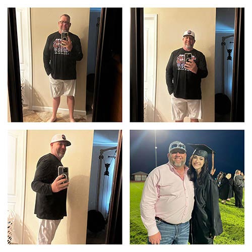 tijuana-bariatrics-gastric-sleeve-before-after_Jonathan-Keith-Junek