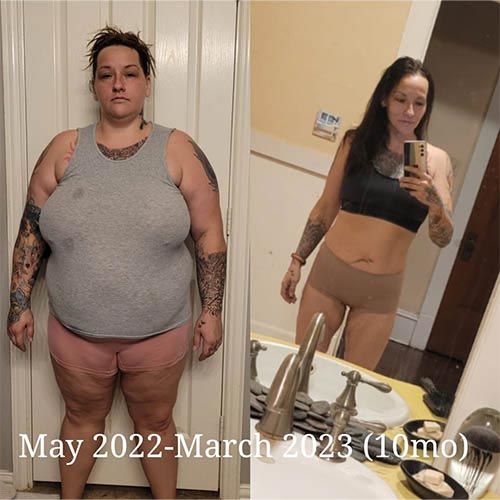 tijuana-bariatrics-gastric-sleeve-before-after_Rebecca-DeSantis