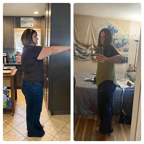 tijuana-bariatrics-gastric-sleeve-before-after_Sara-Marie-Brown